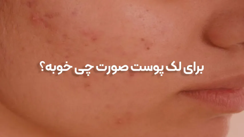 برای لک پوست صورت چی خوبه؟