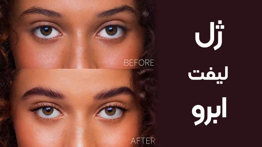 ژل لیفت ابرو