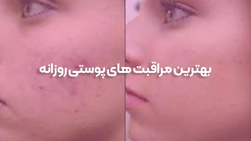بهترین مراقبت های پوستی روزانه