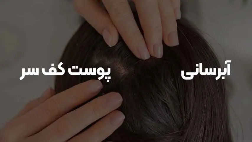 آبرسانی پوست کف سر